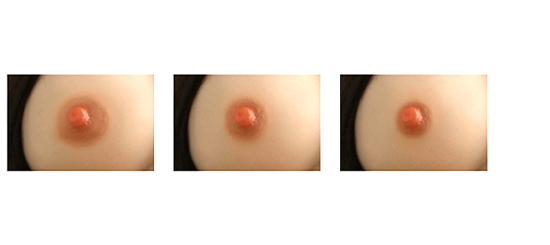 Size of Nipple Areola